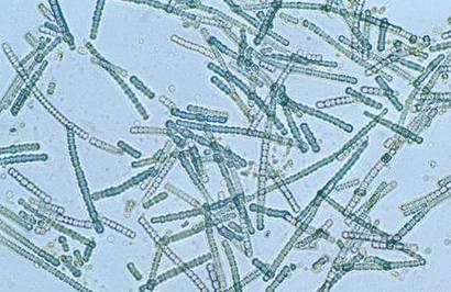 엽록소를 통해 광합성을 할 수 있는 시아노박테리아. 이미지=wikimedia commons