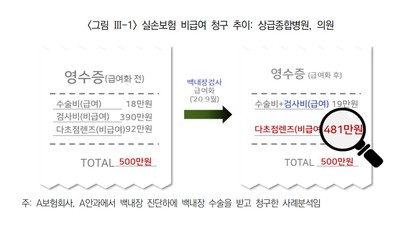 백내장 관련 검사의 평균비용이 경감됨에 따라 다초점렌즈 단가를 인상하는 사례가 발생했다. 사진=보험연구원의 ‘실손의료보험 비급여 보험금 분석’ 보고서